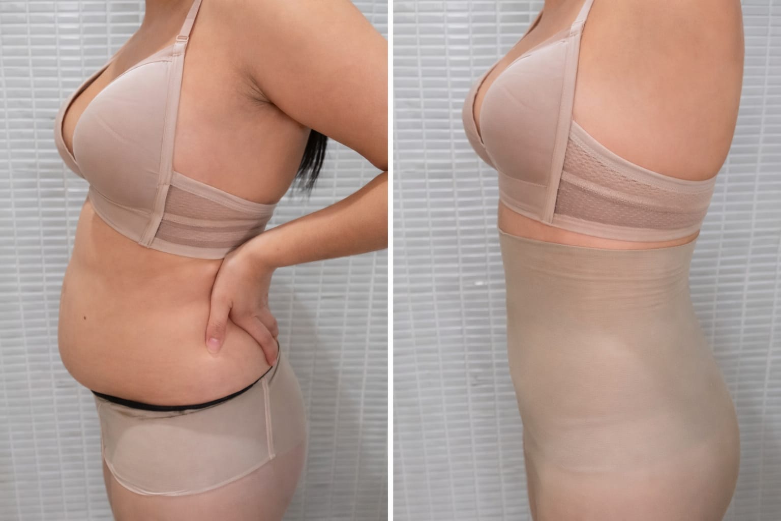 Antes e depois - Mariana L.