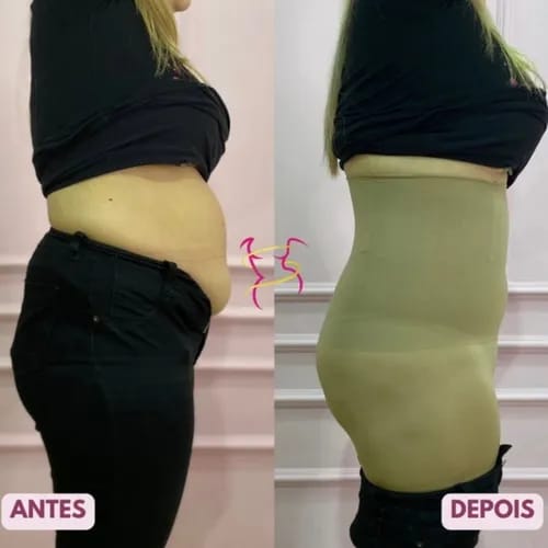 Antes e depois - Camila R.