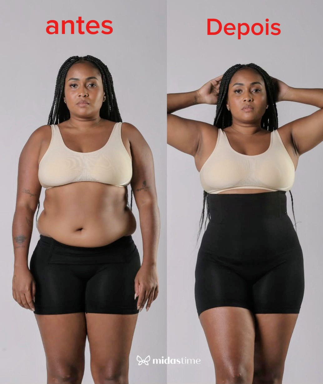 Antes e depois - Beatriz O.